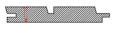 Dura Natur Doppelrhombus