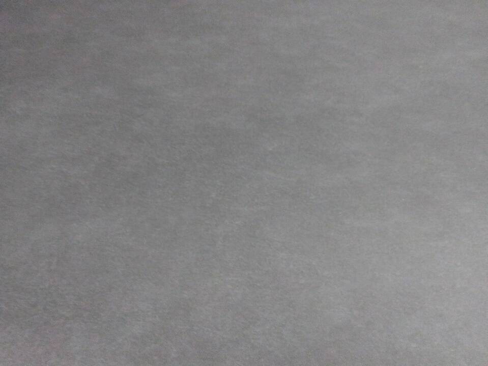 TREMETM2_NA16.jpg